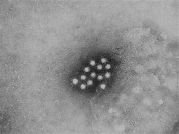 Hepatitis A Virus Bild