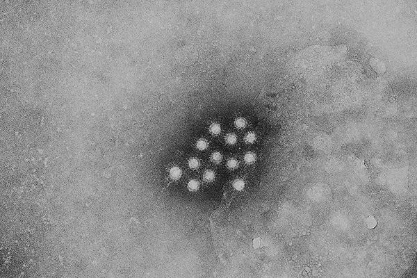 Hepatitis A Viren